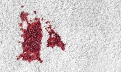 Кровь на ковре